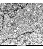 Agar Scientific launches uranium-free UA-Zero EM Stain