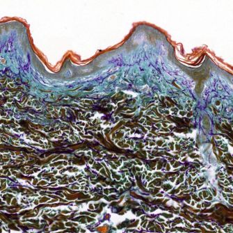 "Human skin section, histology" is licensed under CC BY 4.0
