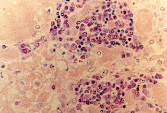 Using LR White for Immunohistochemistry