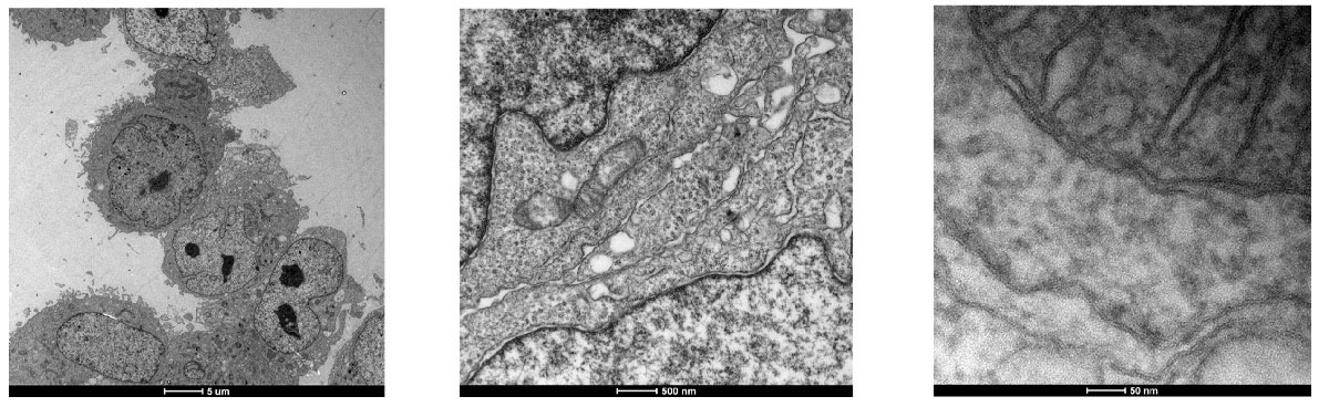 TEM images of the sample prepared using UA-Zero EM Stain in 20% ethanol as staining solution