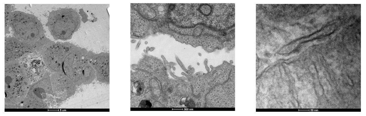 TEM images of sample prepared using 3% Uranyl Acetate in water as staining solution